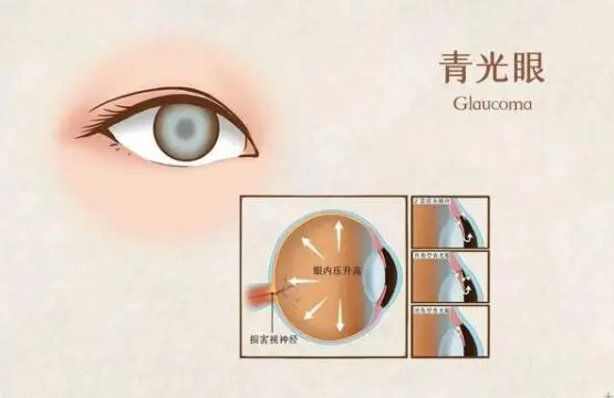 微信图片_20250711100923.png