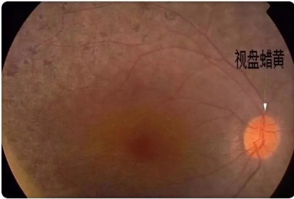 微信截图_20250715102421.png