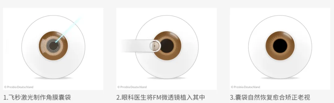 1759398219205469.png d404f67ef513c974d488e6f406d3e5af.png