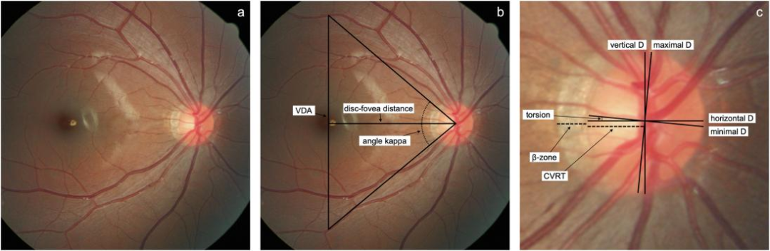 1760602667413952.png 1760602667413952.png