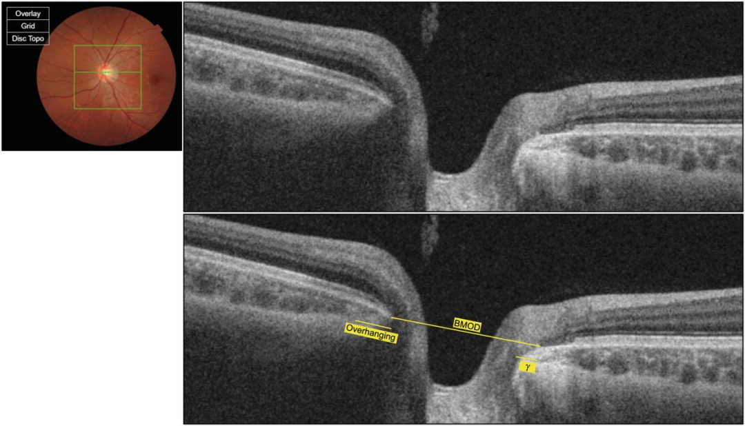 1760602674919702.png 1760602674919702.png