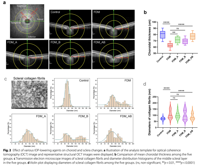 1761805984697611.png 1761805984697611.png